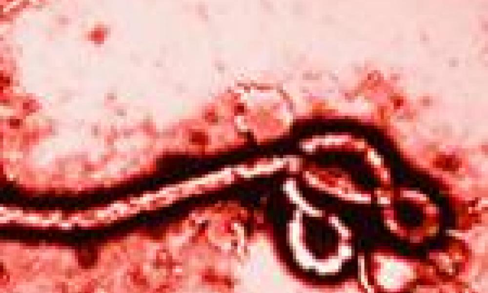 New Research Funding to Strengthen Ebola Response