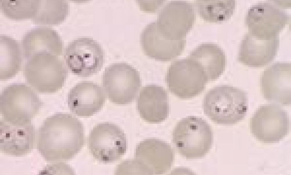 Research Center launches malaria microscopy training pogramme