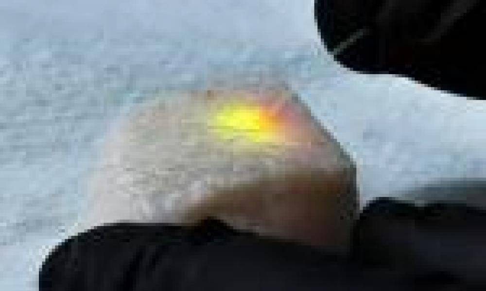 VIRAL: SIU Student turns laser addiction into research