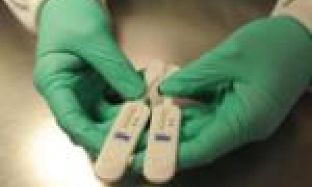 West Africa: Speedy Ebola Test Among UK Projects Given Grant