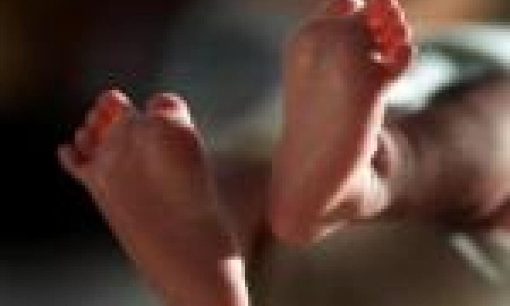 Doctors worried about increasing number of babies born without anus