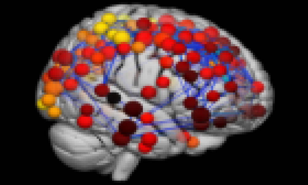 Scans reveal how teenage brain develops