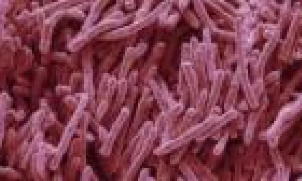 Antibiotics: US discovery labelled 'game-changer' for medicine